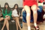 แฟน ๆ สังเกตเห็นว่าสมาชิก GFRIEND มีรอยช้ำที่ขาเพราะท่าเต้นที่ยากจากนักออกแบบของ BTS